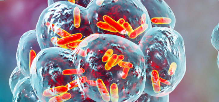 GeneProof Bordetella pertussis/parapertussis PCR Kit