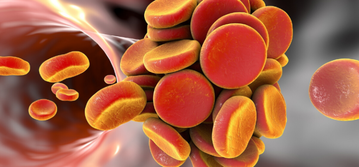 GeneProof Factor V Leiden PCR Kit