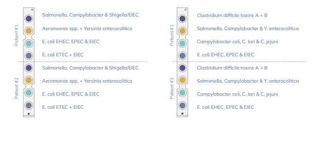 Salmonella, Y. enterocolitica y Campylobacter