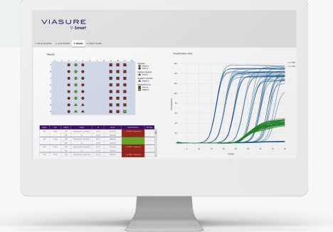 Automatic interpretation