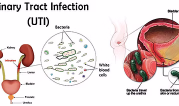 URINARY TRACT INFECTIONS PANEL MAXI KIT