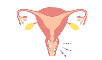 WOMAN HEALTH/VAGINITIS INFECTIONS PANEL MAXI KIT
